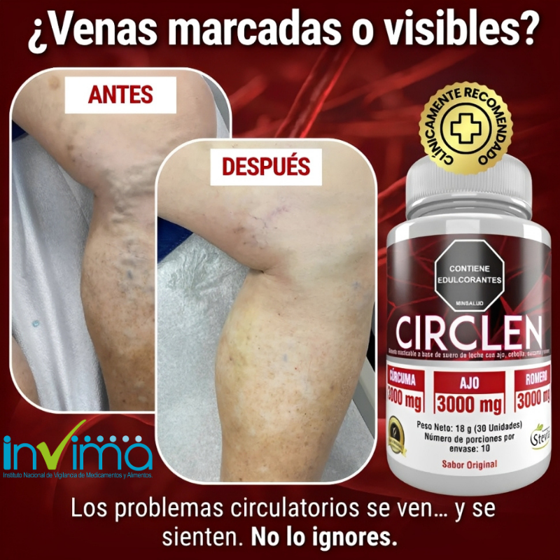 CIRCLENX30